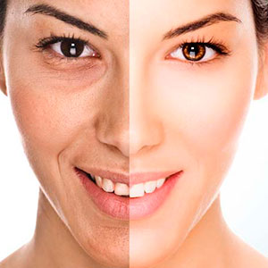antiaging clinica renacer